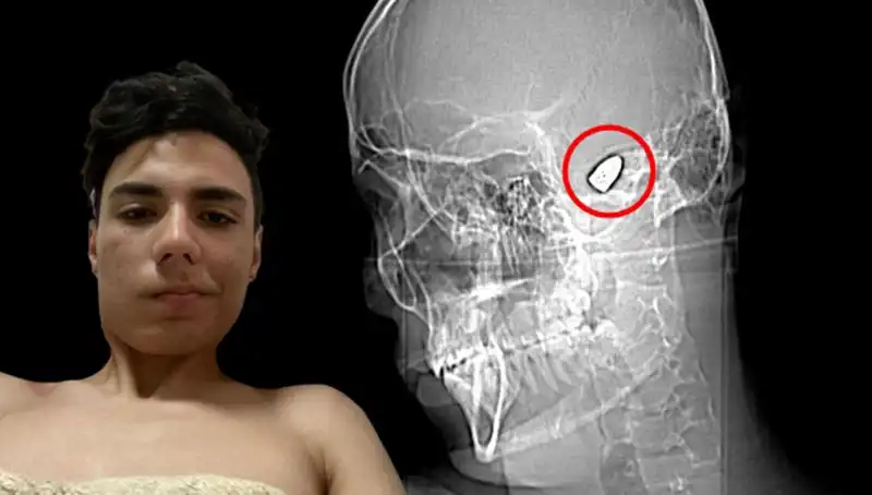 Zihinsel Sağlıkta Yeni Tehdit: Kafasında Patlayıcı Düşünceler Taşıyanlar